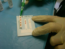 Фильтр-полоску с биопсиями отрывают и помещают для фиксации в пробирку с забуференным формалином