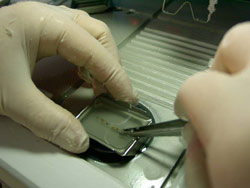 На этапе заливки лаборант- гистолог поворачивает полоски с биопсиями на 90°.